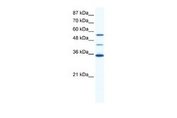 ALX4 Antibody, Novus Biologicals 100 &mu;L; Unconjugated:Antibodies, Polyclonal